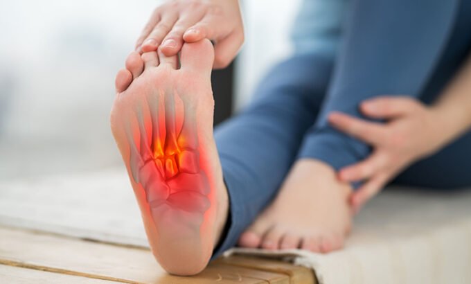 Plantar Fasciitis